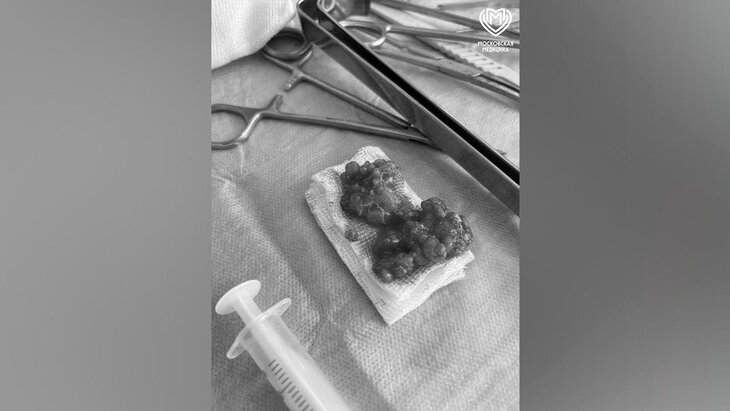 ���������� ����� ������� ��������� � ��������������