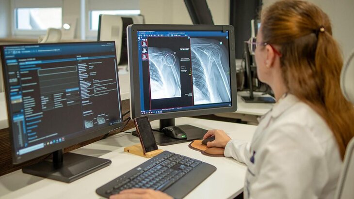 � ������ �������� ��-������ ��� ����������� ��������� �����