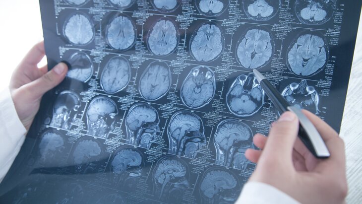 ���� ����������� ��������, ���������� �������� �����